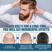 OUHOE Hair Essence Spray, Prevent Hair Loss Repair Hair Dry And Frizzy Moisture And Dense Hair Essence
