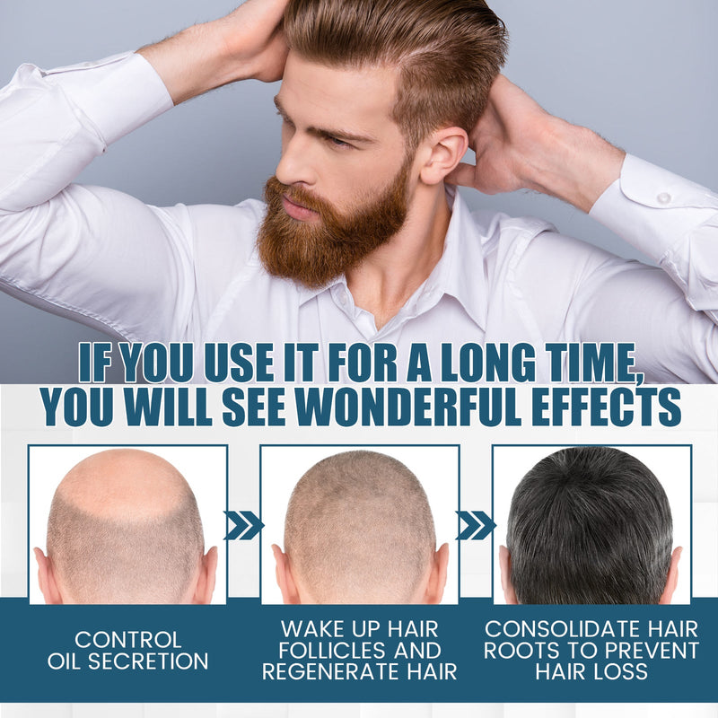OUHOE Hair Essence Spray, Prevent Hair Loss Repair Hair Dry And Frizzy Moisture And Dense Hair Essence
