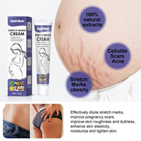 Skin Repair Cream, moisturizing and smoothing post-natal skin repair external cream