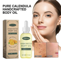 Pure Calendula Handcrafted Body Oil, Reduce Scar Skin Redness Moisturizing Smooth Firming Care