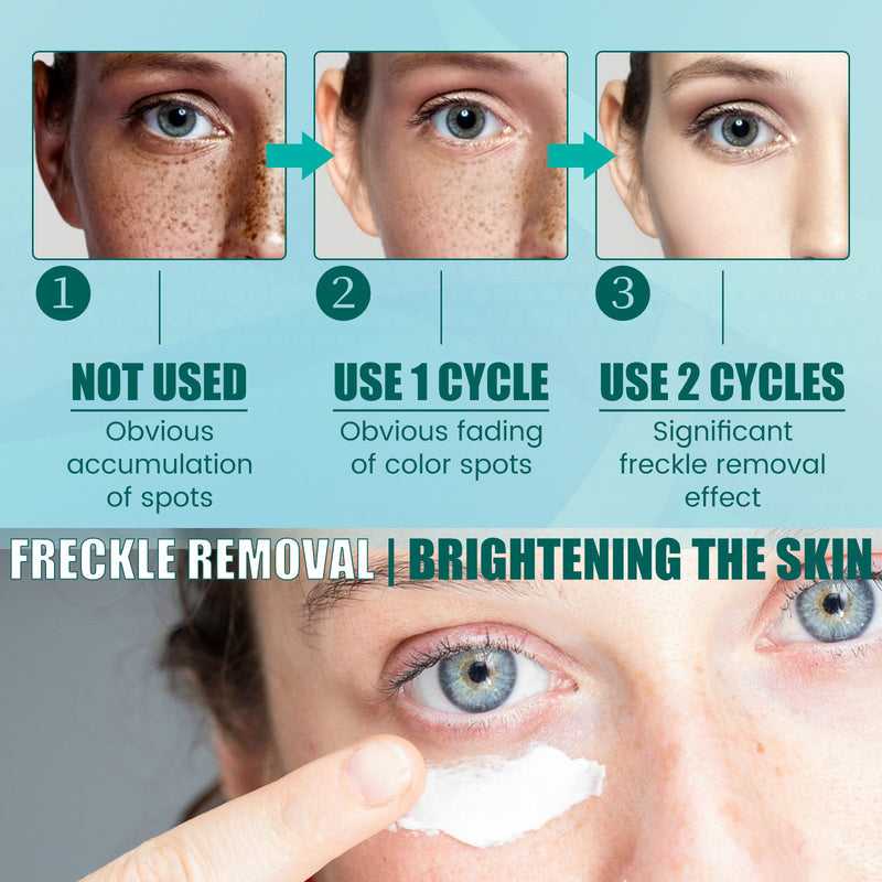 South Moon Facial Care Cream Facial Skin Moisturizing And Hydrating Spot Repair Skin Care Cream
