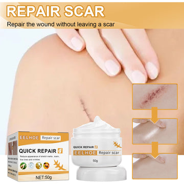 EELHOE Desalting Skin Scar Cream, Skin Burn Scalding Surgical Scar Wound Repair Cream