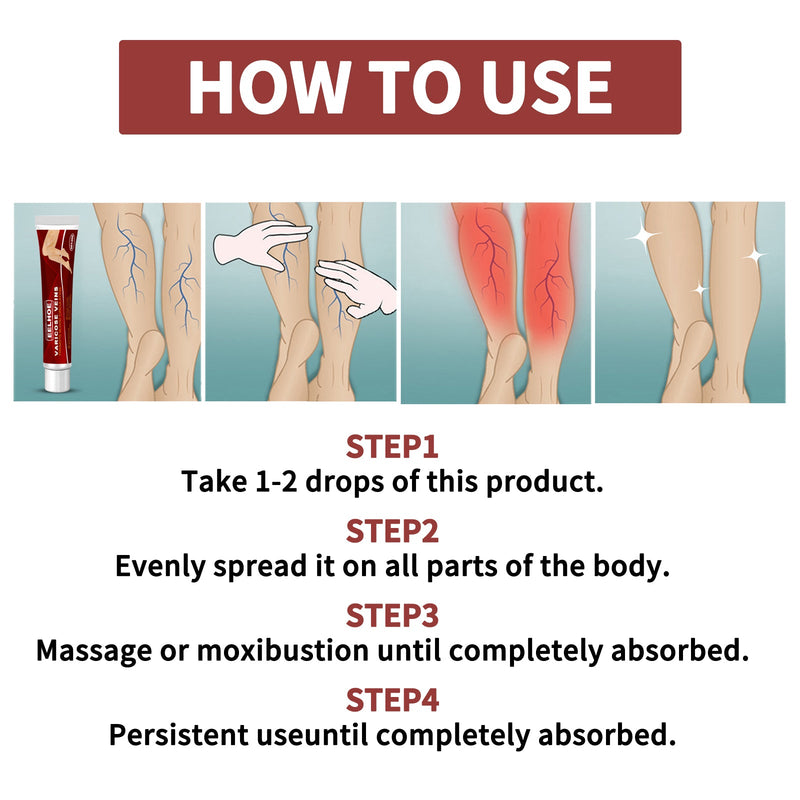 EELHOE Venous Massage Varicose Cream, Relieves Bulging Leg Blood Vessels And Swollen Leg Earthworm Venous Massage Cream