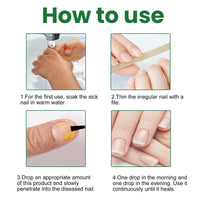 EELHOE Gray Nail Repair Remove Gray Nail Nourishing Lotion, Brightening Soft Nails Moisturizing Nail Care Solution For Hands, Feet And Nails