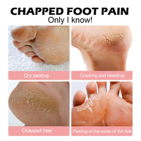 Anti-Crack Hand And Foot Moisturizer, Foot Care Anti-Crack And Dead Skin, Hand And Foot Skin Moisturizer