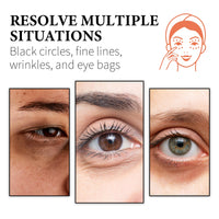 WIYUN Retinol & Collagen Moisturizer Eye Cream, Lightening Dark Circles And Bags Under Eyes Moisturizing Firming Care Multi-Effect Eye Cream