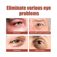Eye Care Eye Cream, Reduces Fine Lines, Bags And Dark Circles, Skin Around Eyes Moisturizes And Tightens Cream