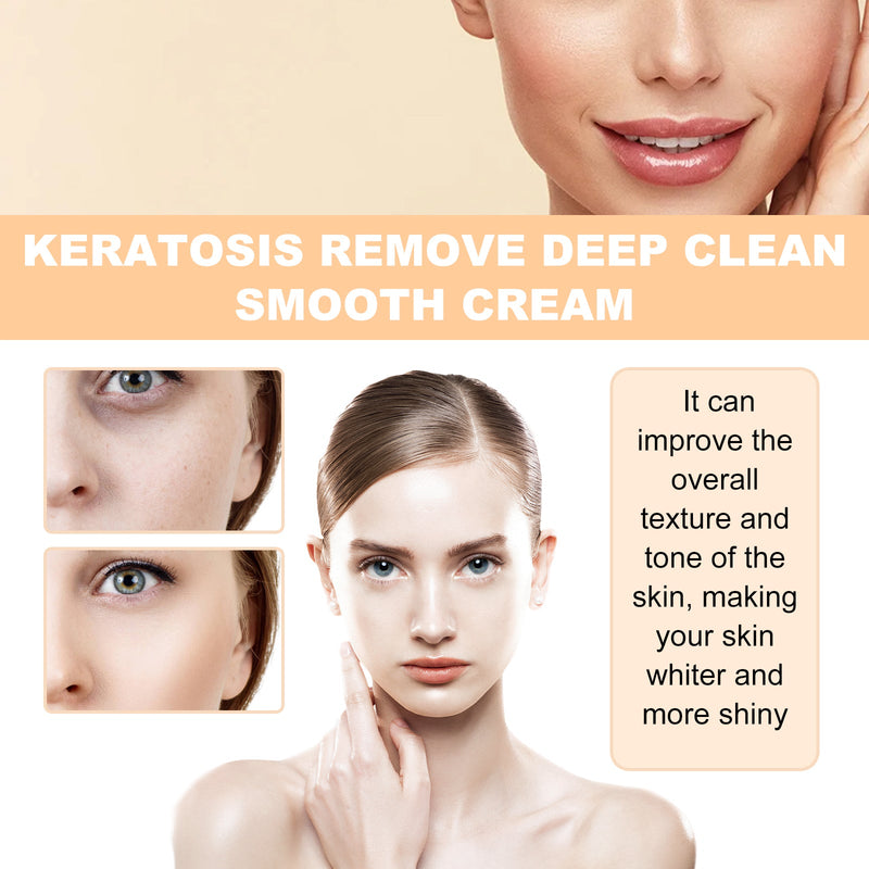 Keratosis Remove Deep Clean Smooth Cream, Clear Skin Acne Exfoliating Unclog Pores Moisturizing Tender And Smooth Skin
