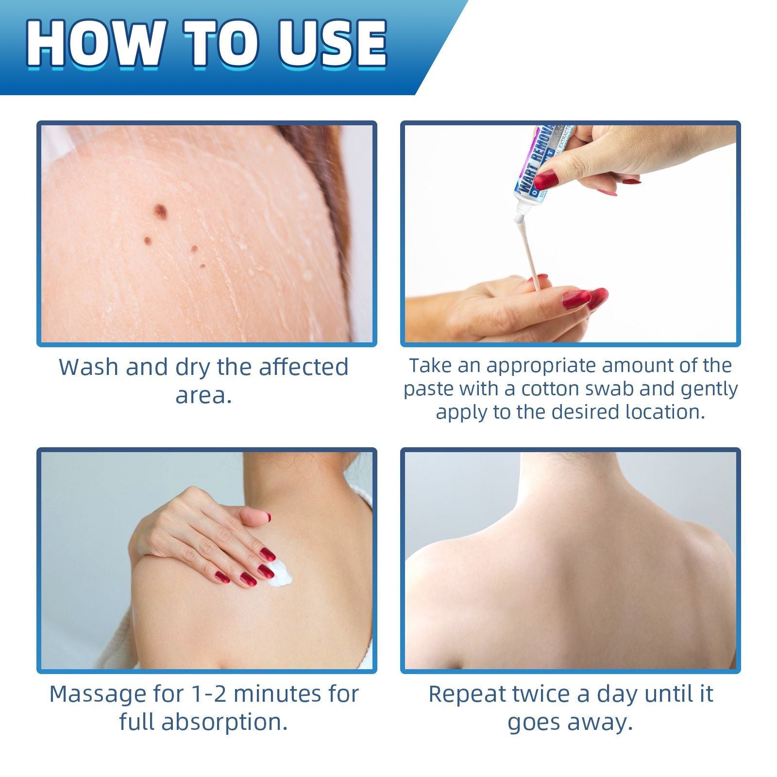 Warts Cream, Repair Skin Granules Gram Wart Body Care Topical Cream