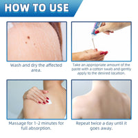 Warts Cream, Repair Skin Granules Gram Wart Body Care Topical Cream