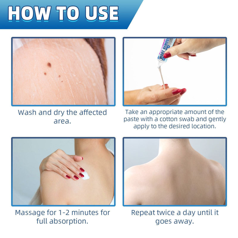 Warts Cream, Repair Skin Granules Gram Wart Body Care Topical Cream