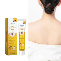 Bee Venom Wart Cream, Repair Smooth Skin Lightening Nevus Spot Nevus Cure Wart Care Cream
