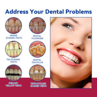Anti-Cavity Gum Health Toothpaste, Clean Teeth Yellow Stains And Tartar Breath Fresh Clean Tooth Care Toothpaste