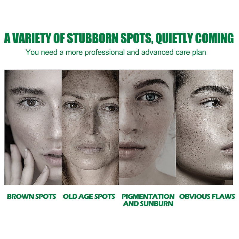 EELHOE Dark Spot Correcting Glow Serum - Fades Freckles & Melanin, Repair Care