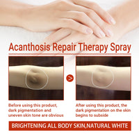Black Acanthoderma Treatment Spray Cleanses Horny Joints Black Whitening Spray Melanin Repair Underarms