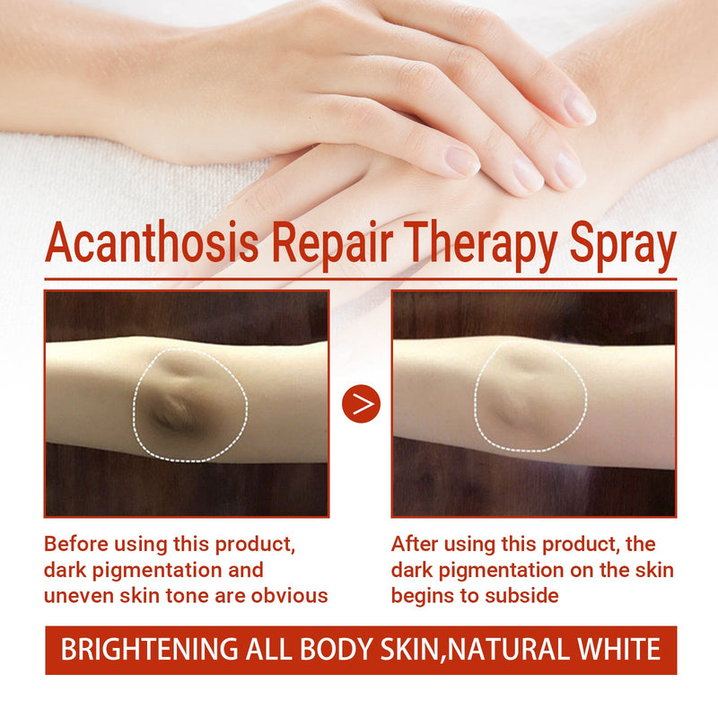 Black Acanthoderma Treatment Spray Cleanses Horny Joints Black Whitening Spray Melanin Repair Underarms