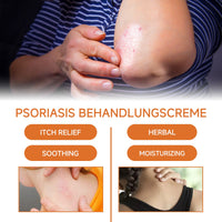 Psoriasis Behandlungscreme, Relieve Hand And Foot Skin Redness, Relieve Itching, Repair And Moisturize Skin Care