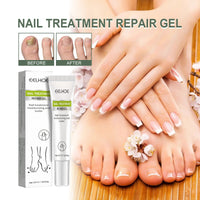 Hand, Foot And Nail Repair, Soft Nail Polish Polish Gel