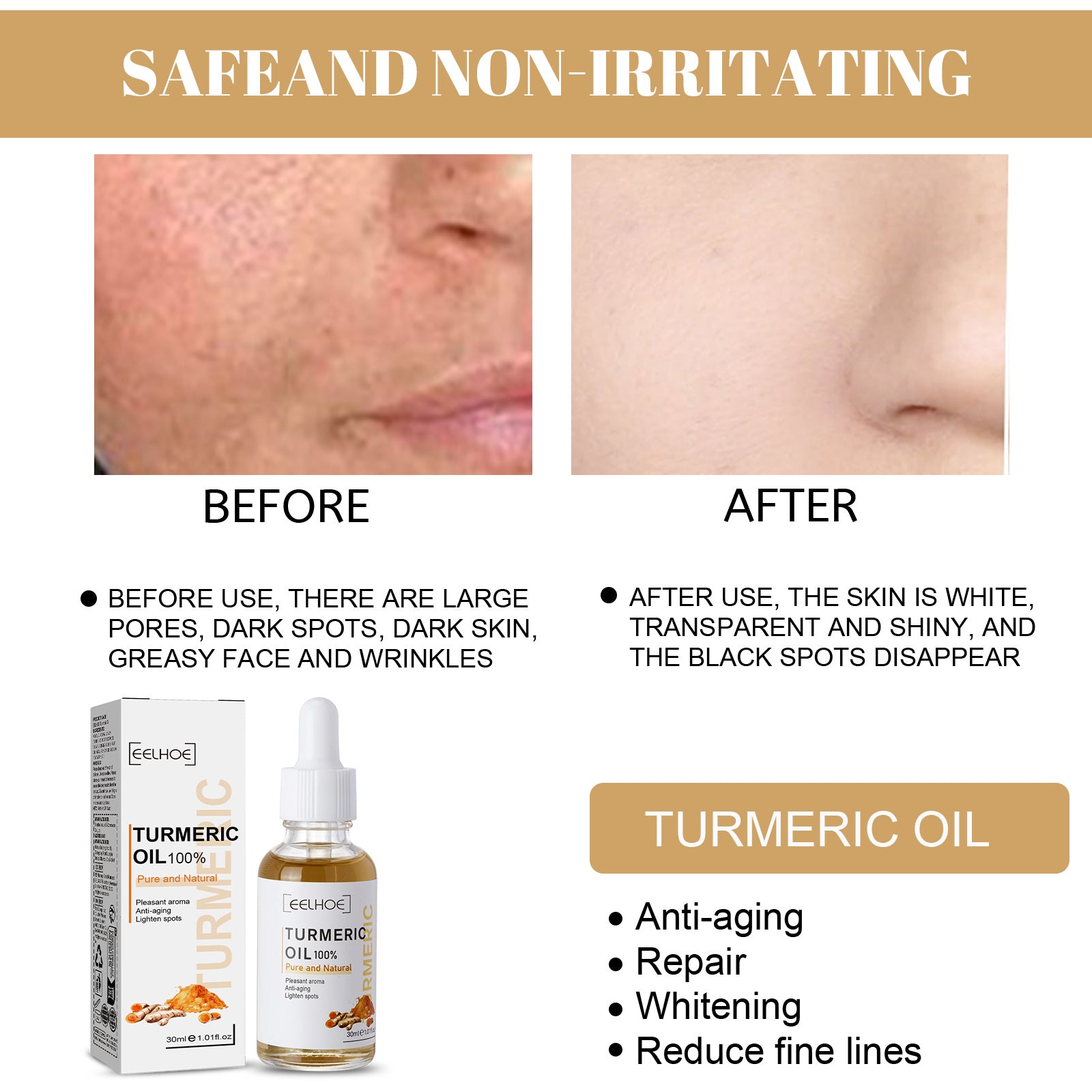 EELHOE Turmeric Correction Essence Facial Care Hydrating Moisturizing Gentle Moisturizing Skin Care Essence