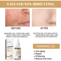 EELHOE Turmeric Correction Essence Facial Care Hydrating Moisturizing Gentle Moisturizing Skin Care Essence