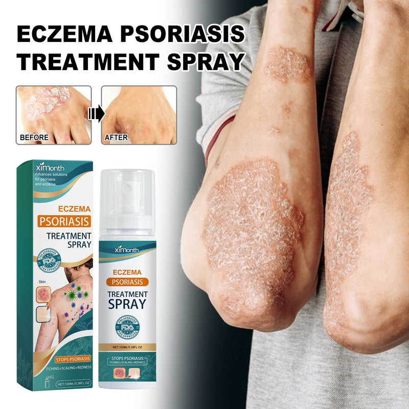 Eczema Psoriasis Treatment Spray, Repair The Brotherhood Of Skin Itchy Moss Alleviate Redness Itching Skin Care