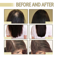 Rosemary Dense Hair Essential Oil, Prevent Hair Loss, Repair Frizz And Dry Hair Dense Hair Essential Oil