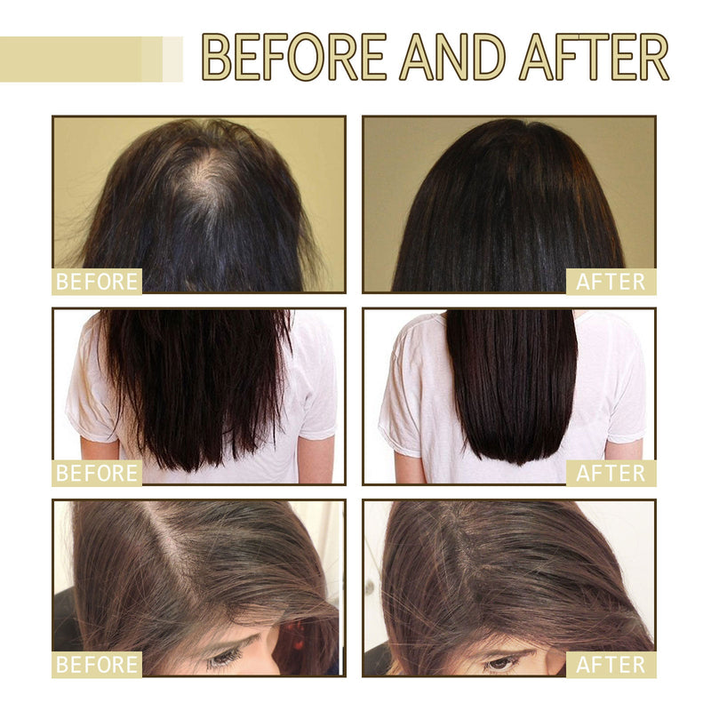 Rosemary Dense Hair Essential Oil, Prevent Hair Loss, Repair Frizz And Dry Hair Dense Hair Essential Oil