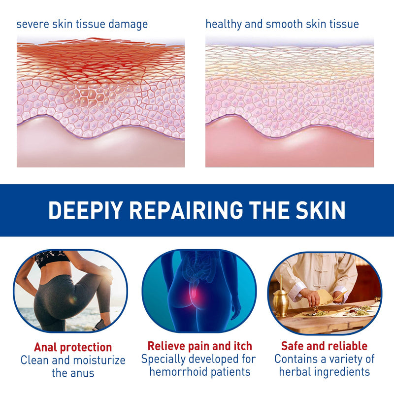 Hemorrhoid Cream, Repair The Swelling And Itching Of The Anus And Eliminate Meat Ball Mixed Nevus Anal Pain Relief Cream