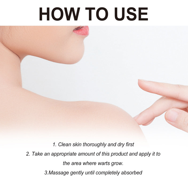 Wart Essence, Cleanses Skin, Restores And Smooths Body Skin Wart Treatment