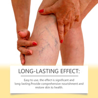 Bee Venom Iv Cream Soothes Leg Fatigue And Improves Venous Circulation With Plant Extract Cream