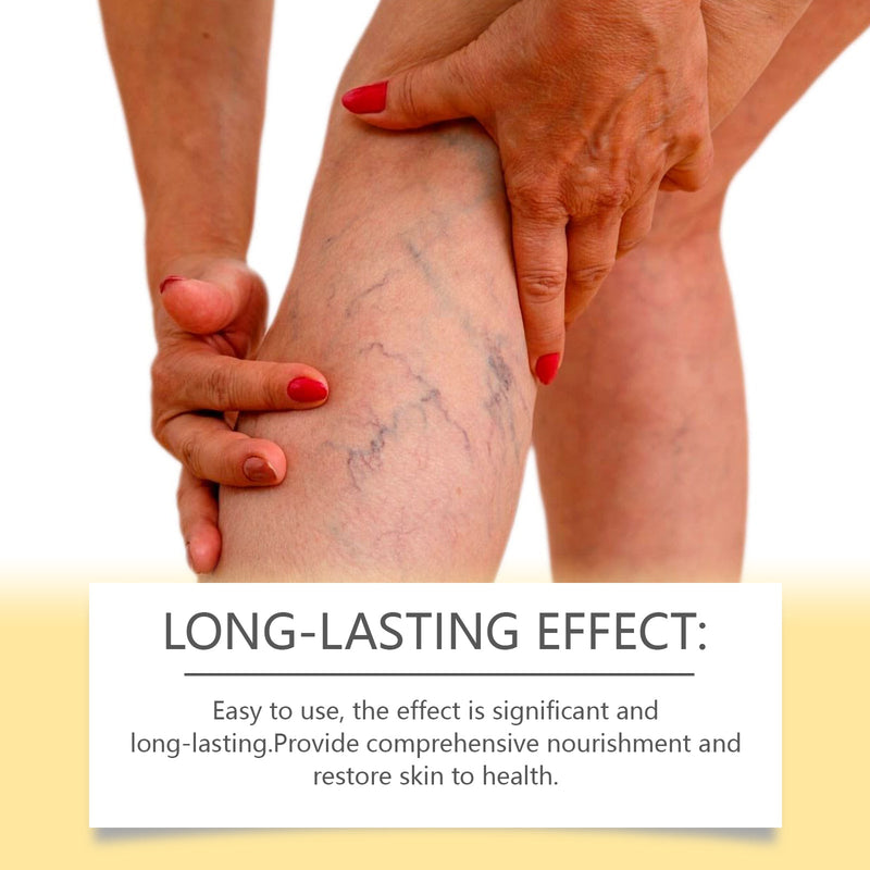 Bee Venom Iv Cream Soothes Leg Fatigue And Improves Venous Circulation With Plant Extract Cream