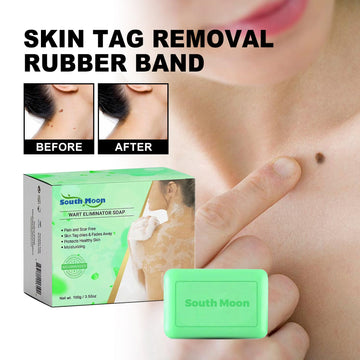 South Moon Skin Tag Removal Rubber Band, Remove Moles Remove Warts Face Neck Flesh Granule Body Cleansing Soap