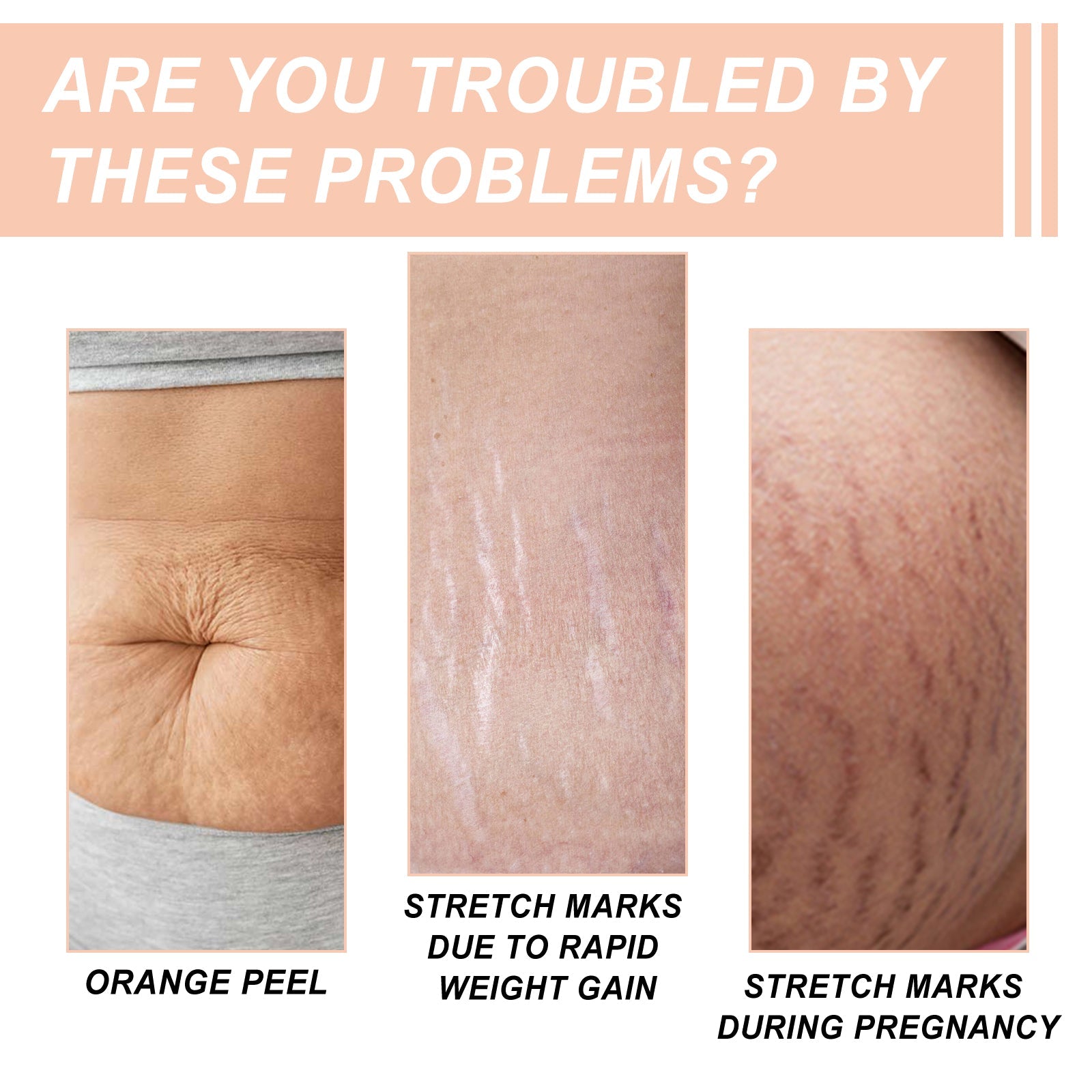Snail Essence Pregnancy Stretch Mark Cream, Firming Skin Repair Lighten Postpartum Pregnancy Marks And Gestational Fat Smoothing Cream