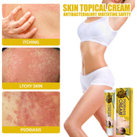 South Moon Skin Care Cream Body Skin Moisturizing Repair Topical Application Ointment Skin Cream