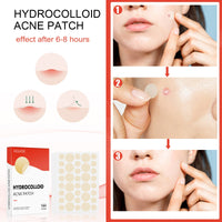 EELHOE Hydrocolloid Acne Patch Face Invisible Makeup Closed Mouth Acne Clear Acne Waterproof Breathable Facial Treatment