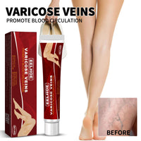 EELHOE Venous Massage Varicose Cream, Relieves Bulging Leg Blood Vessels And Swollen Leg Earthworm Venous Massage Cream