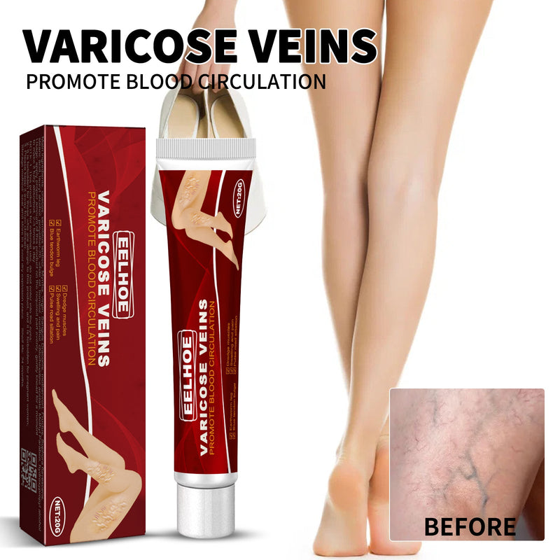 EELHOE Venous Massage Varicose Cream, Relieves Bulging Leg Blood Vessels And Swollen Leg Earthworm Venous Massage Cream