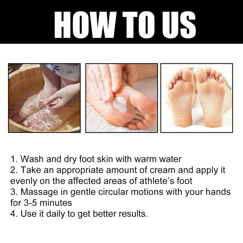 Foot Deodorant Cream, Foot Itch Relief, Beriberi Odor Control, Dry Peeling Cream For Rotten Feet