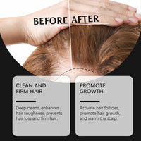 Hoegoa Rice Shampoo Scalp Cleansing Nourish Hair Repair Hair Follicles Smooth Hair Shampoo
