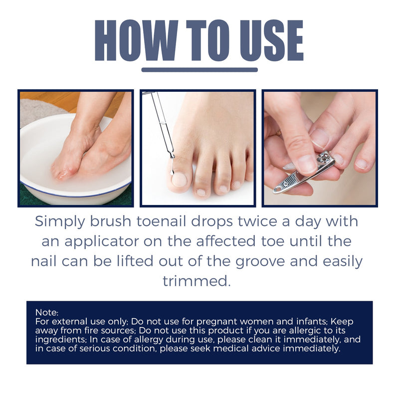 Nail Repair Oil Hand And Foot Repair Inlaid Toenails Soft Nails Daily Moisturizing Nail Care