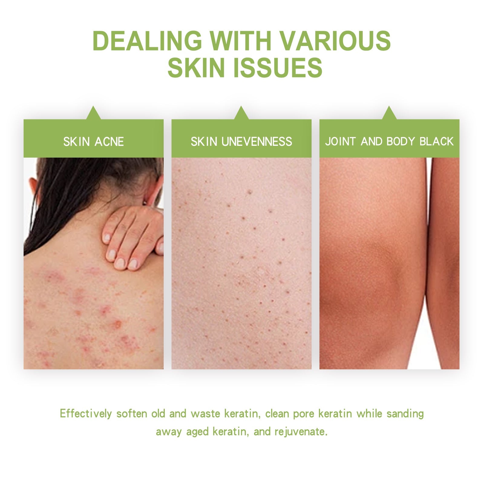 OCEAURA Avocado Body Exfoliating Scrub, Clear Skin Exfoliating Dead Skin Smooth And Brightening Skin Scrub