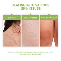 OCEAURA Avocado Body Exfoliating Scrub, Clear Skin Exfoliating Dead Skin Smooth And Brightening Skin Scrub