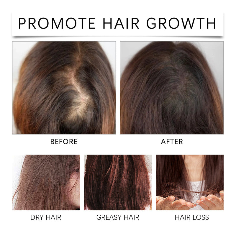 Palm Oil Hair Care Essence, Scalp Massage Treatment Repair Dry Hair, Soft And Solid Hair