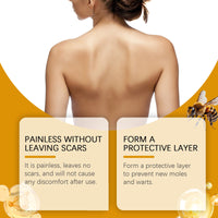 West&Month Bee Venom Keyu Mole Care Cream, Moisturizes And Smoothes The Skin, Lightening The Skin Flesh Granules And Body Care