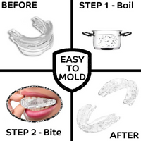 Anti Snoring Bruxism Mouth Guard Teeth Bruxism Sleeping Apnea Guard Snoring Mouth Guard Snoring Device to Stop Snoring