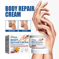Body Repair Cream, Relieve Peeling Improve Chapped Dry Skin And Remove Dead Skin Moisturize Cream