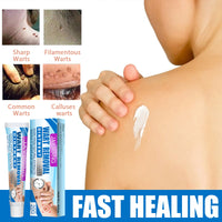 Warts Cream, Repair Skin Granules Gram Wart Body Care Topical Cream