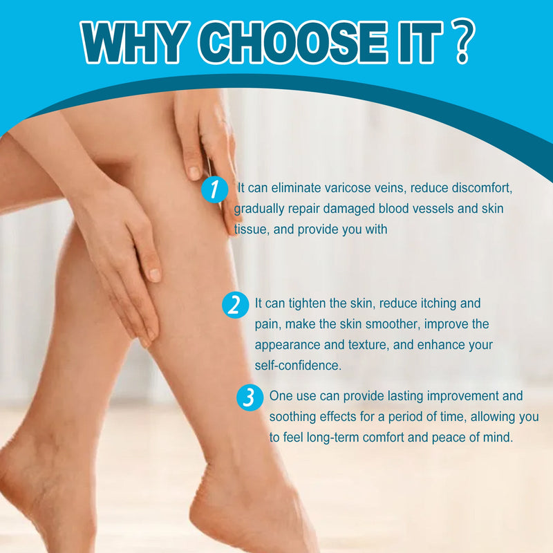 Varicose Veins Cream, Muscle Soreness And Swelling Relief Discomfort Smoothing Blood Vessel Massage Cream