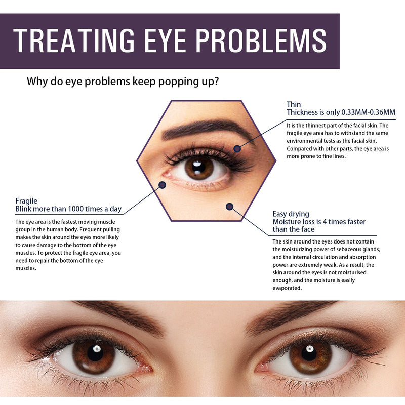 Eelhoe Electric Anti-Wrinkle Eye Cream Lifts, Strengthens, Moisturizes And Reduces Fine Lines, Bags And Dark Circles Under Eye Care
