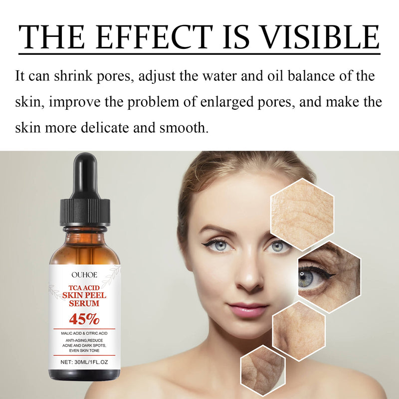 OUHOE TCA Acid Skin Peel Serum - Exfoliating Brightening Skin Care